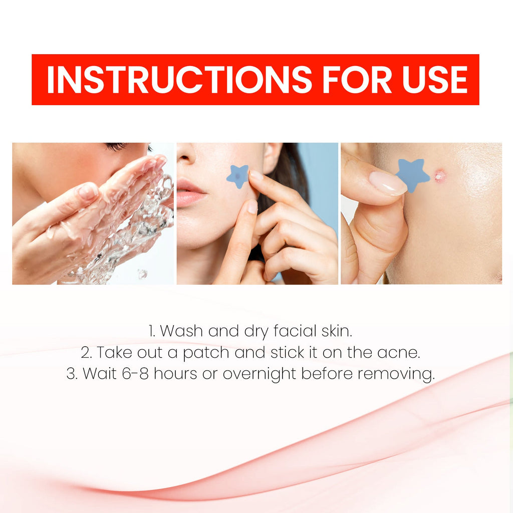 Patch Anti-Acné Réparateur – 200 Patchs Hydrocolloïdes, Tous Types de Peau 🌿✨ Yiwu Ruijia Auto Supplies Co., Ltd.