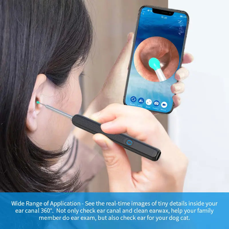 NE3 Ear Cleaner Otoscope Ear Wax Removal Tool With Camera LED Light Wireless Ear Endoscope Ear Cleaning Kit For I-phone Yiwu Ruijia Auto Supplies Co., Ltd.