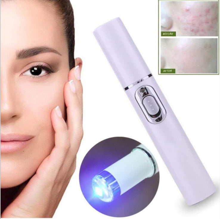 Stylo Laser Anti-Acné – Microcourant et Lumière Bleue 415 nm pour Peau Grasse et Sensible Yiwu Ruijia Auto Supplies Co., Ltd.