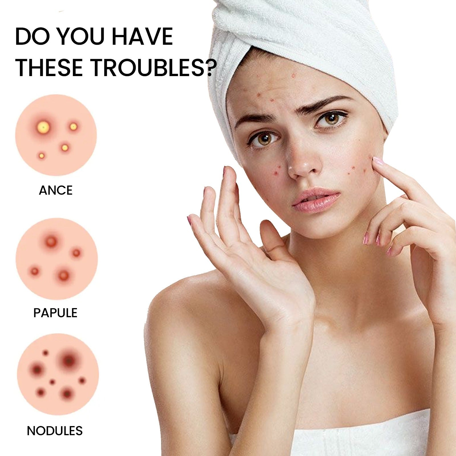 Patch Anti-Acné Réparateur – 200 Patchs Hydrocolloïdes, Tous Types de Peau 🌿✨ Yiwu Ruijia Auto Supplies Co., Ltd.