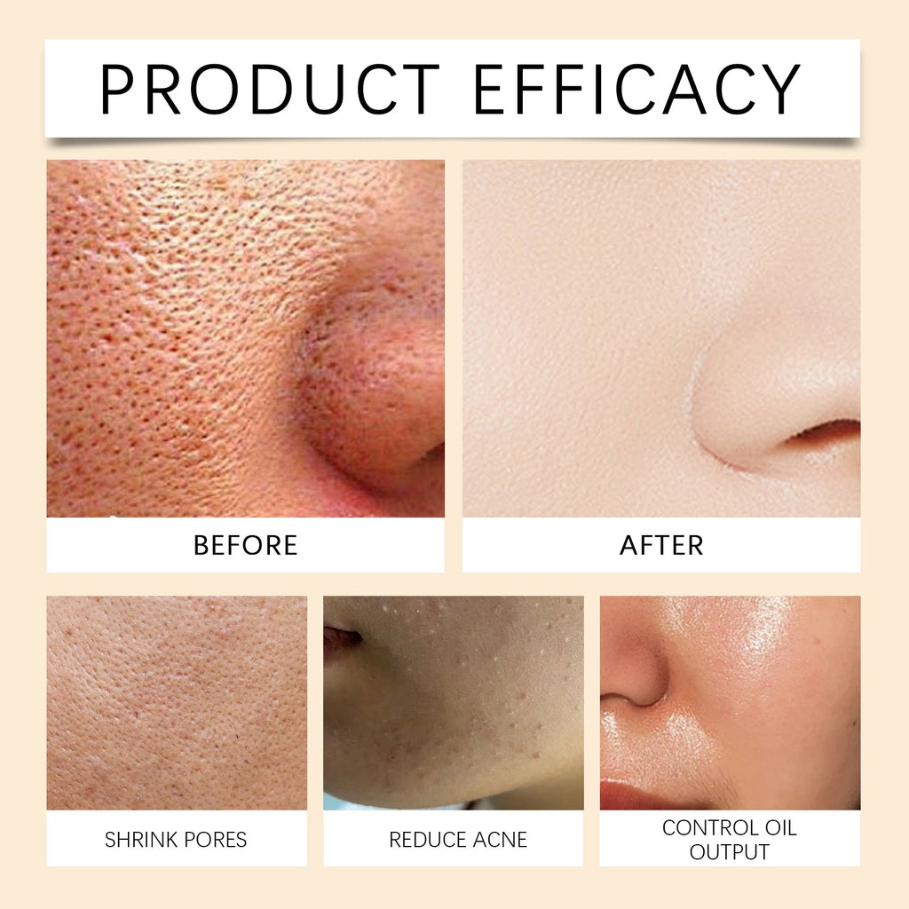 Nettoyant Visage au Curcuma – Anti-Acné, Antibactérien &amp; Brosse Incluse 🌿✨ Yiwu Ruijia Auto Supplies Co., Ltd.
