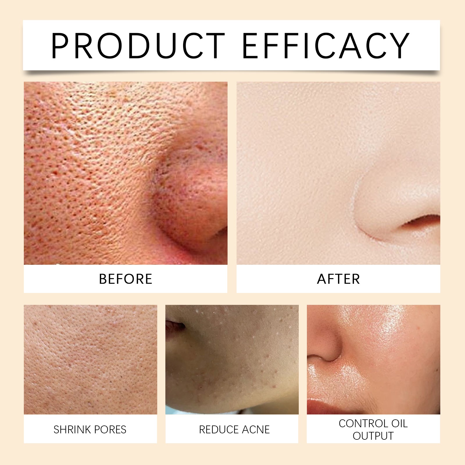 Nettoyant Visage au Curcuma – Anti-Acné, Antibactérien &amp; Brosse Incluse 🌿✨ Yiwu Ruijia Auto Supplies Co., Ltd.