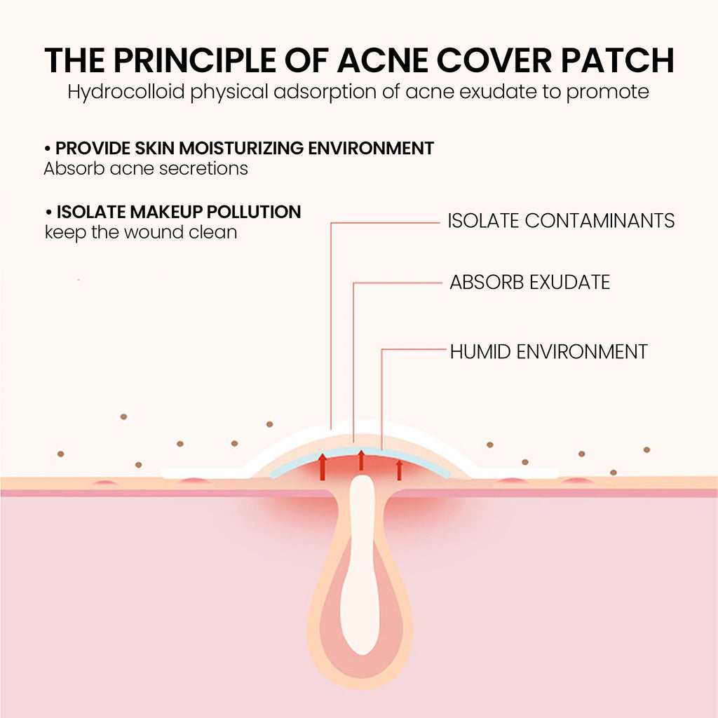 Patch Anti-Acné Réparateur – 200 Patchs Hydrocolloïdes, Tous Types de Peau 🌿✨ Yiwu Ruijia Auto Supplies Co., Ltd.