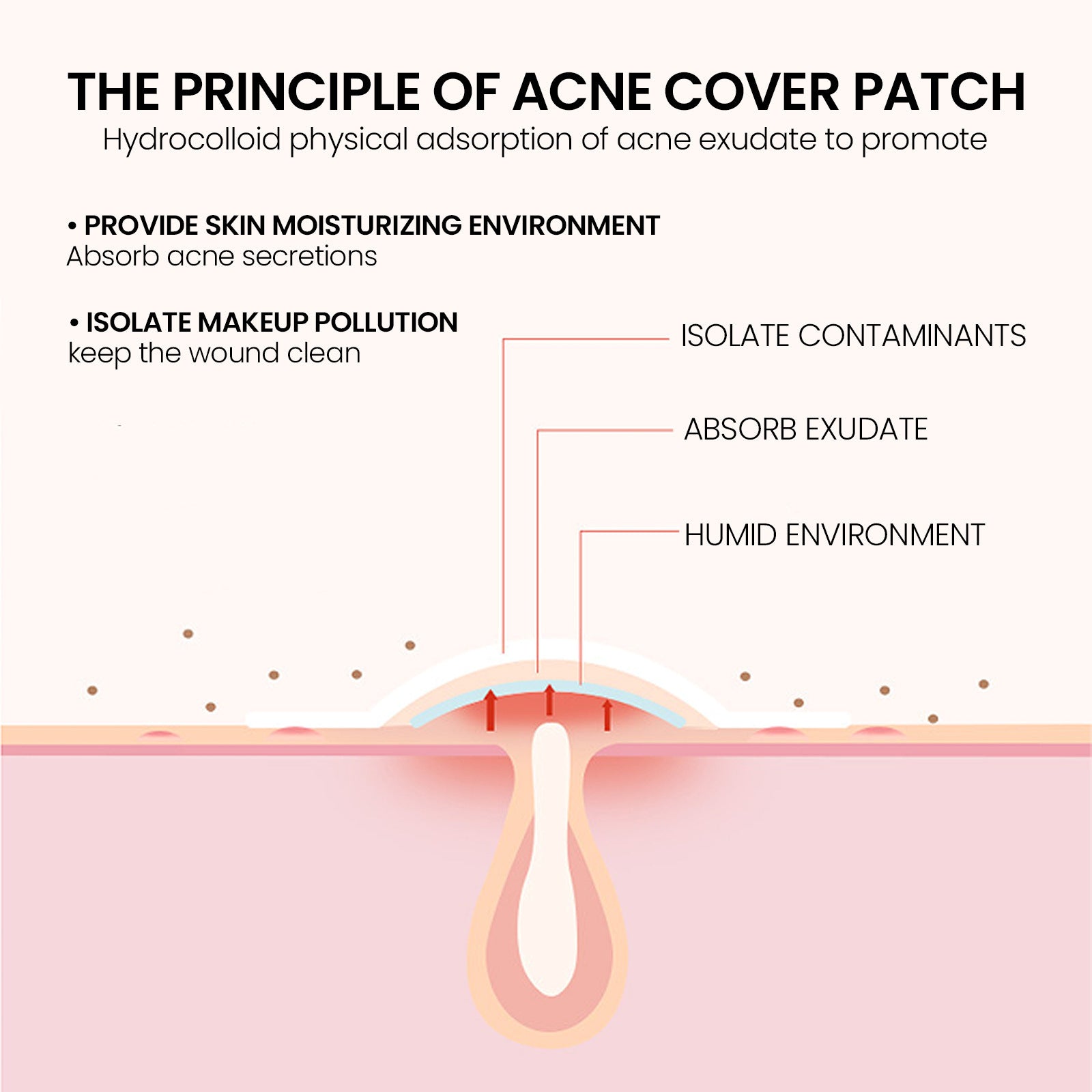 Patch Anti-Acné Réparateur – 200 Patchs Hydrocolloïdes, Tous Types de Peau 🌿✨ Yiwu Ruijia Auto Supplies Co., Ltd.