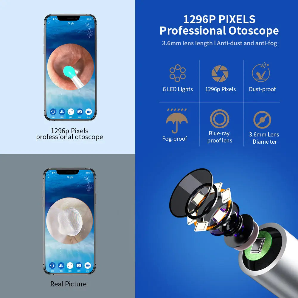 NE3 Ear Cleaner Otoscope Ear Wax Removal Tool With Camera LED Light Wireless Ear Endoscope Ear Cleaning Kit For I-phone Yiwu Ruijia Auto Supplies Co., Ltd.